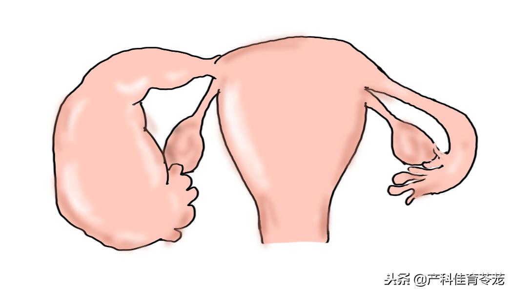 妇科b超报告单解析,妇科b超报告单几个月有效