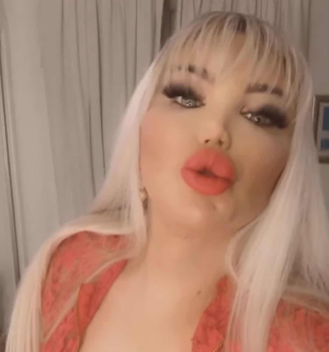 巴西男整容42次图片,巴西男模花数百万整容