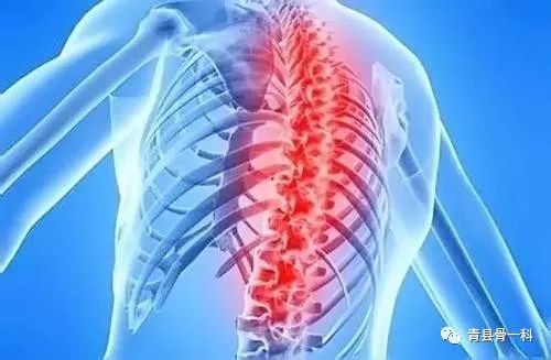 骨质增生骨刺最好的治疗方法,骨刺和骨质增生的治疗方法