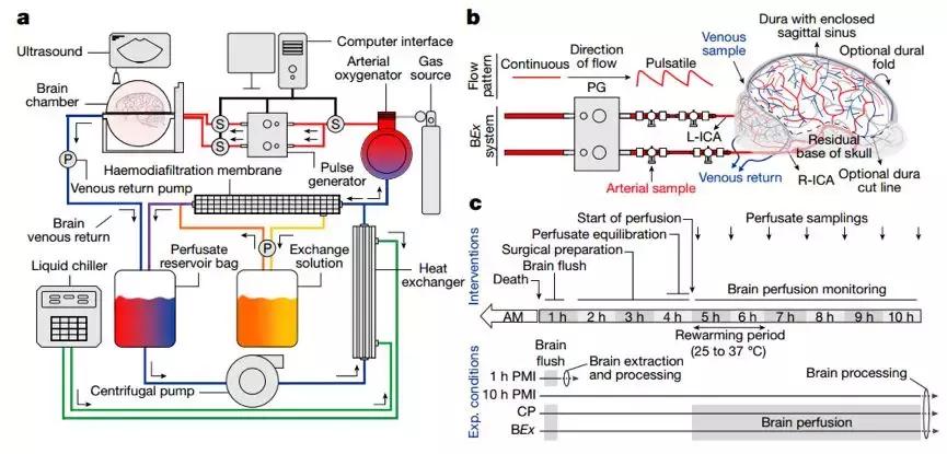 死亡为什么叫脑死亡,脑死亡是什么意义上的死亡