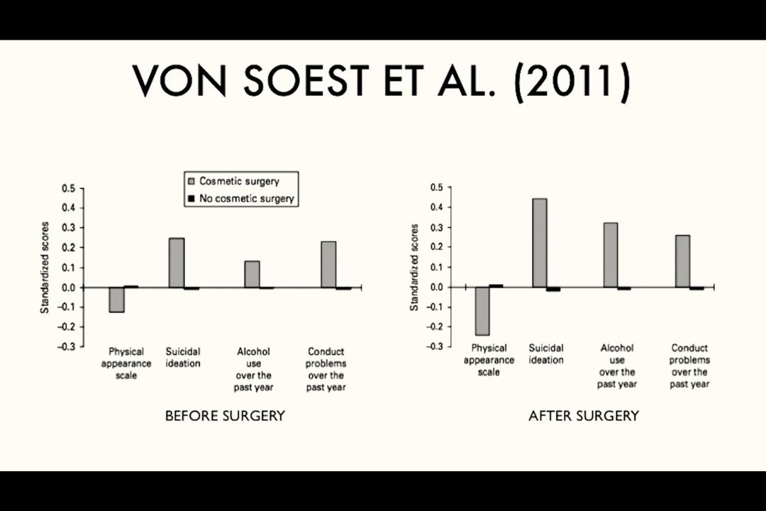 到底该不该全切双眼皮,怎么判断自己该不该割双眼皮