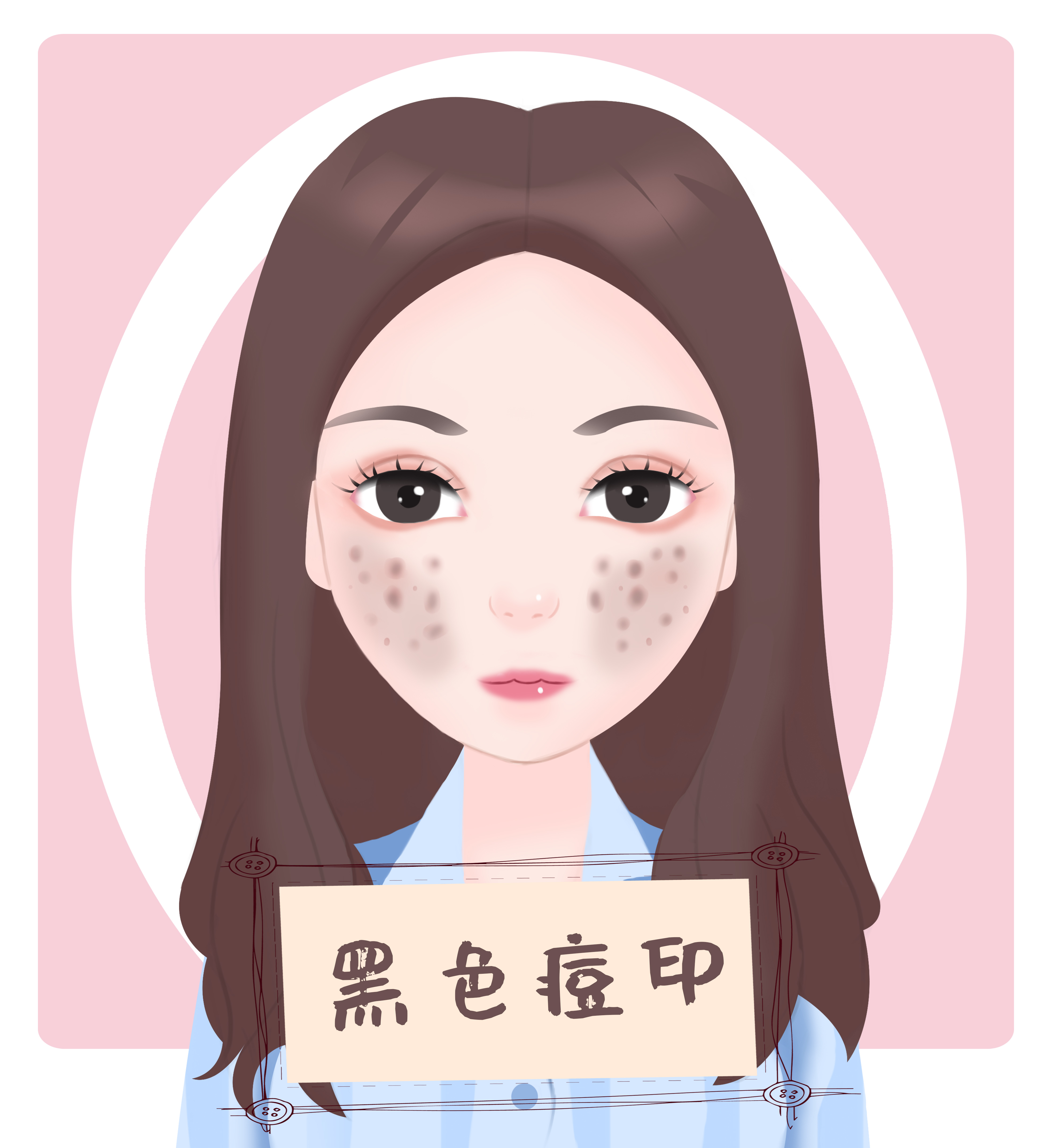 产后痘印怎么快速消除,如何快速消除痘印最有效方法