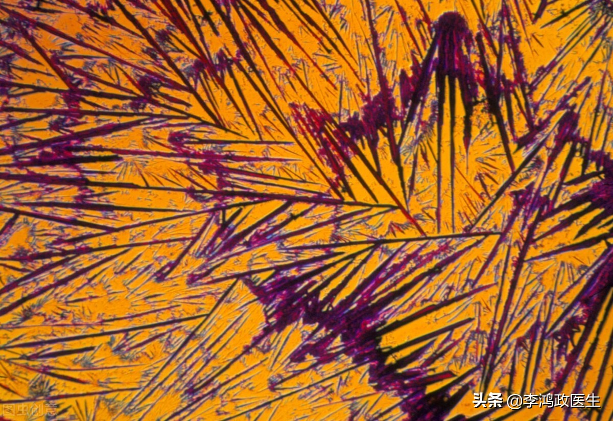 臀部肉疙瘩手术治疗全过程,女性屁股长了一个肉疙瘩怎么治