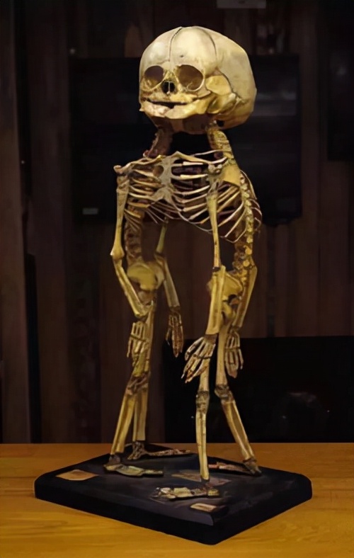 爱因斯坦的大脑解剖全过程,爱因斯坦的大脑为科学奉献一生