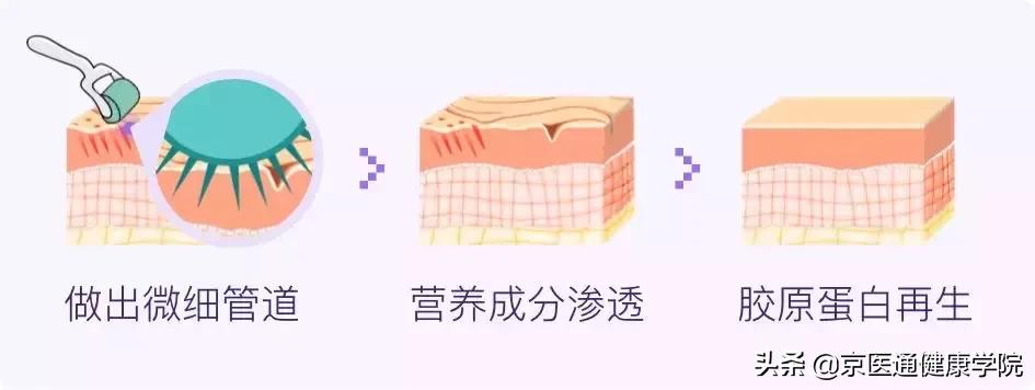 被吹上天却没什么用的保健品,被吹上天的阿胶