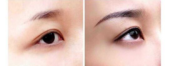 纹眉你们后悔了吗,那些纹纹身后悔了的人