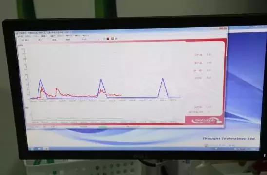 宁波盆底肌修复排行榜,宁波第一医院盆底肌修复