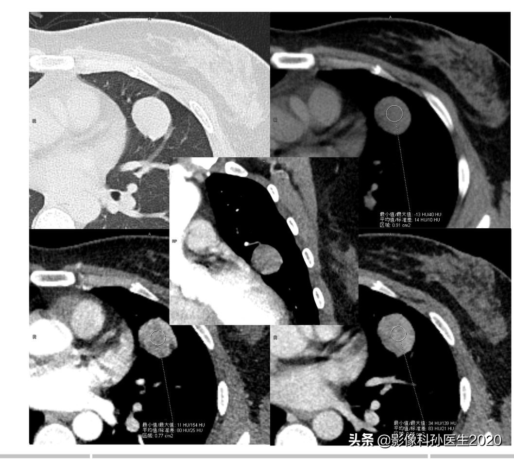 case2操作,case2背景