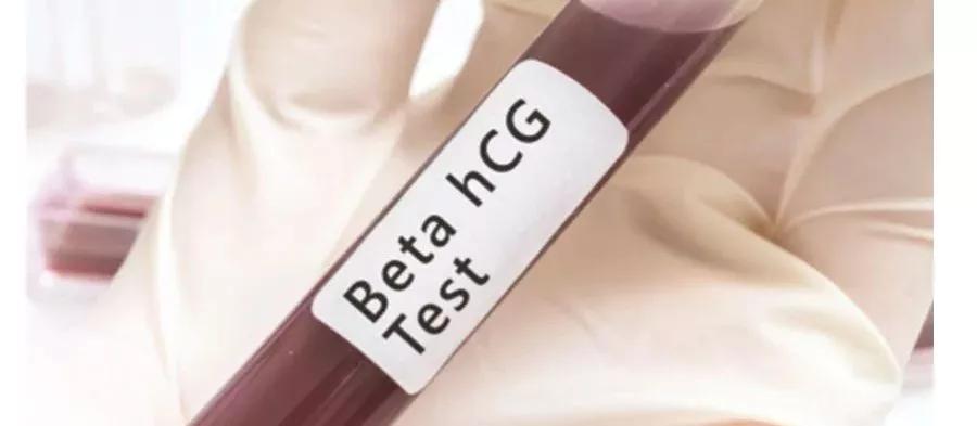 早孕试纸可以观察hcg吗,早孕期超声筛查是免费的吗