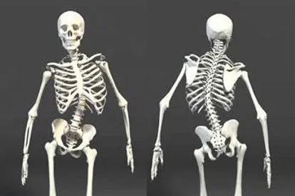 腰间盘突出腰弯了怎么矫正,腰间盘突出脊柱侧弯矫正视频