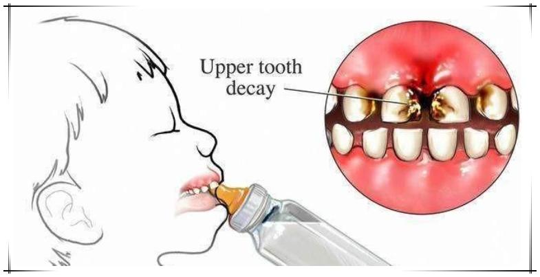 宝宝喝奶粉常见问题以及解决方法,宝宝喝奶粉的猛涨期应该怎样喂