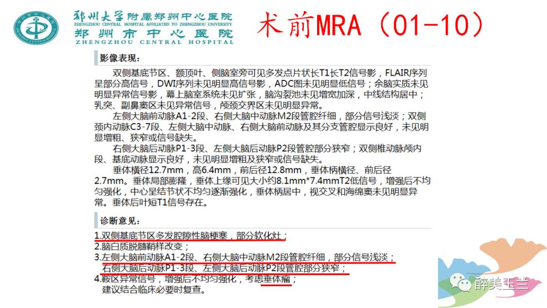 局麻药中毒的术前用药口诀,局麻药中毒临床表现及处理流程ppt