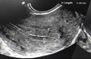 胚胎｜说说胚胎那些事