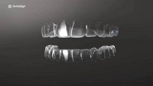 现在矫正牙技术成熟吗,矫正牙齿不要花冤枉钱