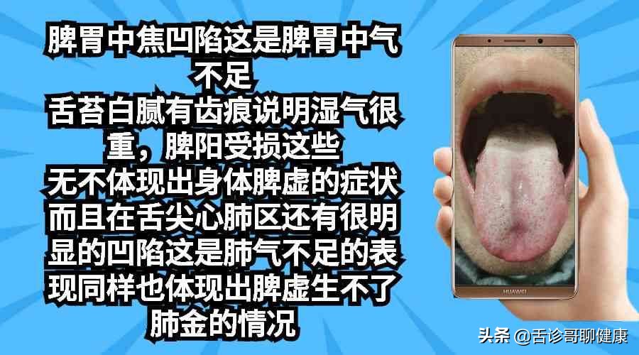 舌诊哥聊血瘀,舌诊哥聊健康肝胆