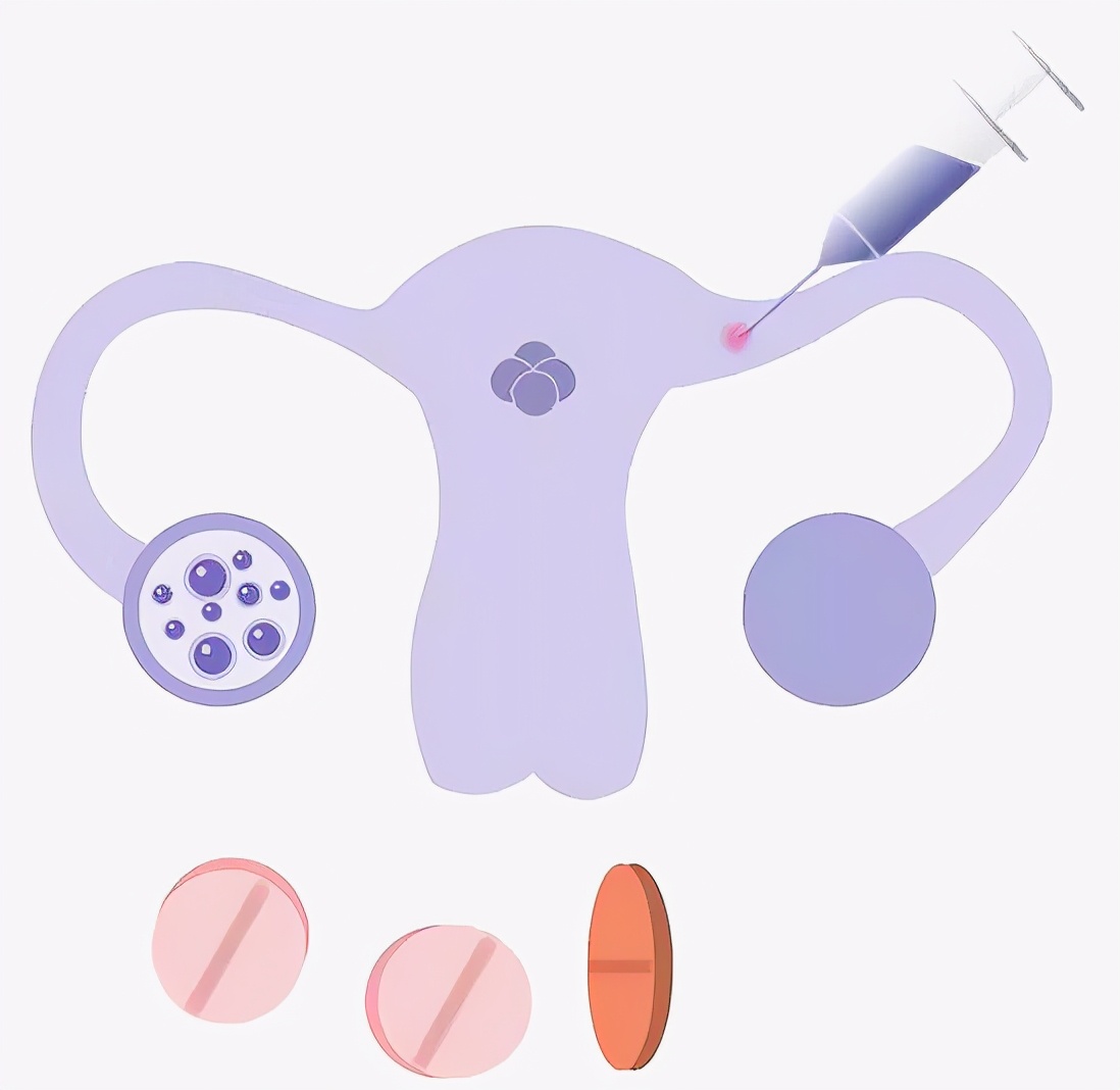 试管移植后紧张焦虑怎么办,试管移植后过度紧张怕走快