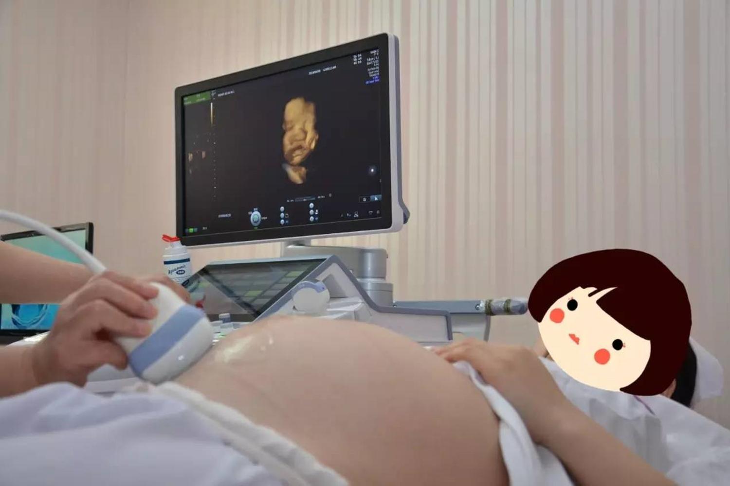 准妈妈被宝宝丑哭了,四维照的宝宝怎么这么丑