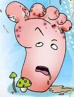 引起脚肿痛的原因有哪些,脚痒一定要警惕