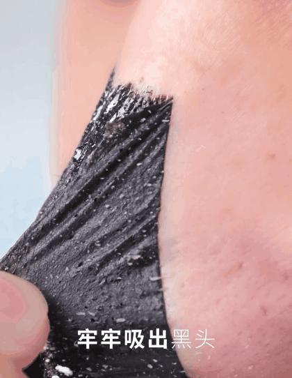 亲测真正有效去黑头粉刺产品,黑头连根拔起还会再长吗