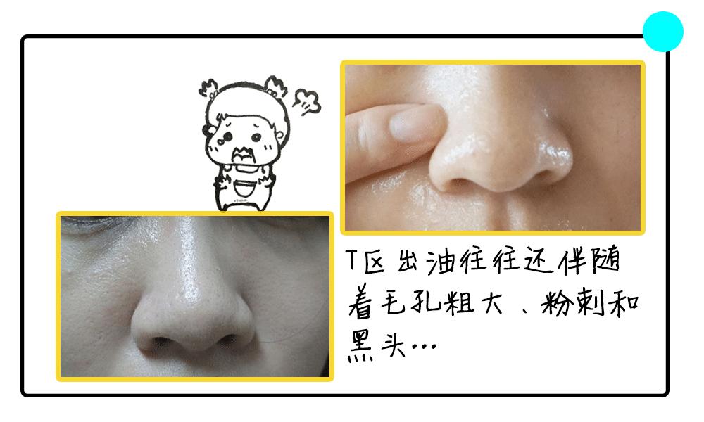 出油脱妆怎么补救,出油晕妆的护理方法