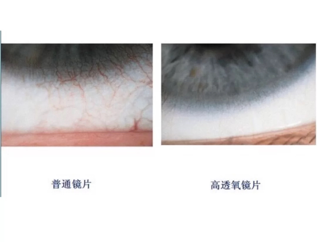 隐形眼镜三无产品,大品牌隐形眼镜半年抛