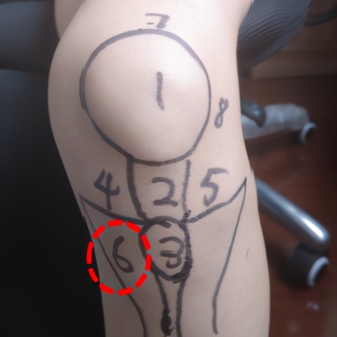 不同部位膝关节,骨科医生教你一招搞定膝盖痛