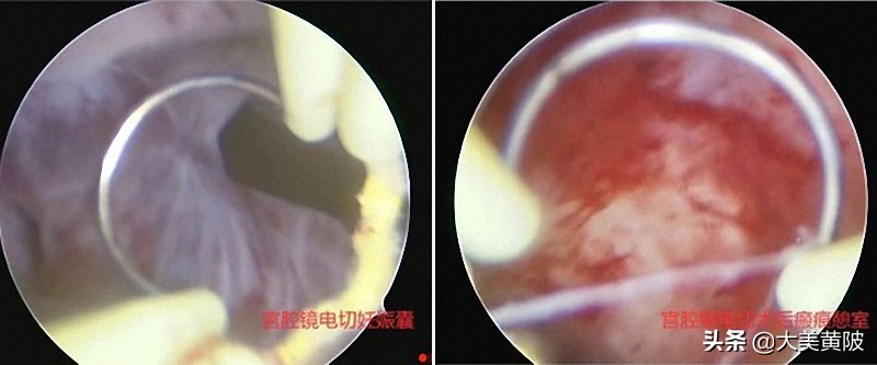 黄陂区人民医院妇产科怎么样,黄陂区人民医院看妇科怎么样