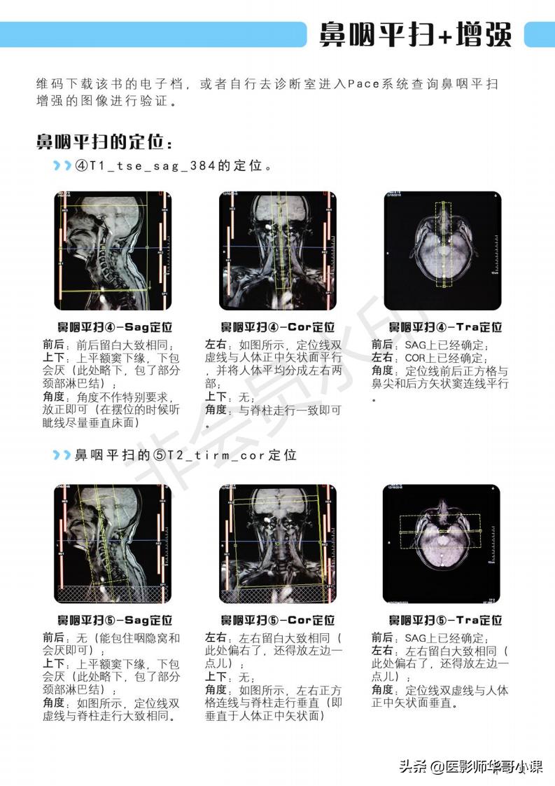 磁共振扫描技术西门子,西门子磁共振最新操作界面