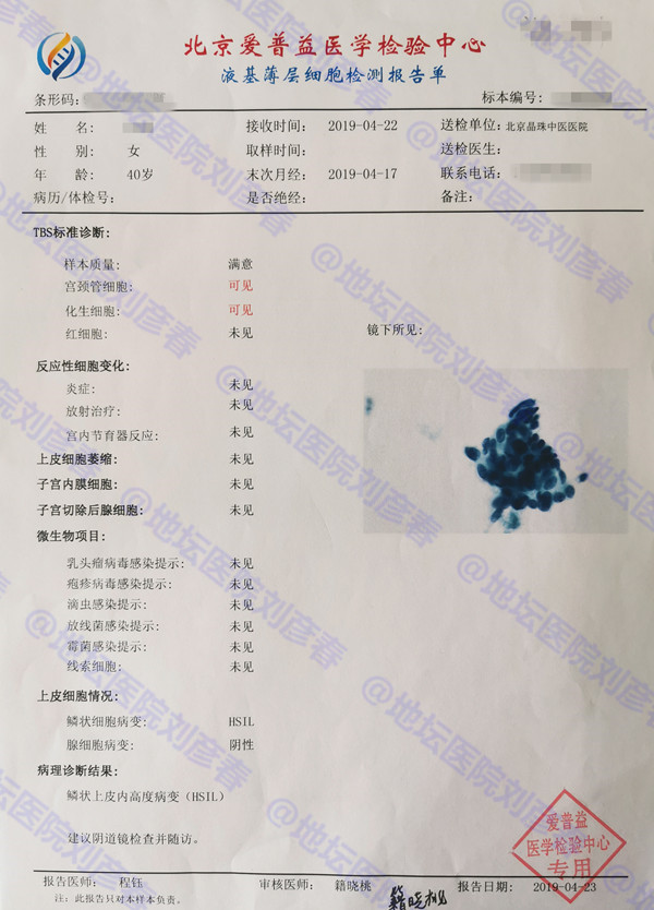 hpv16cin3锥切后会转阴几率,病例分享报告