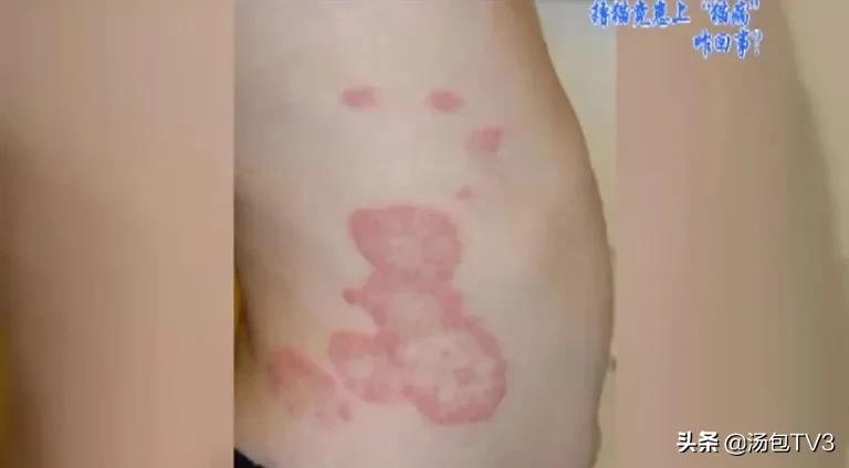 撸猫容易得什么病,经常撸猫容易得什么病