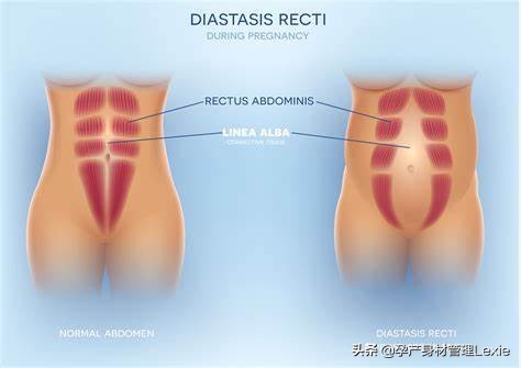 减脂塑形瘦身的最快方法,减脂锻炼腹直肌的最快动作
