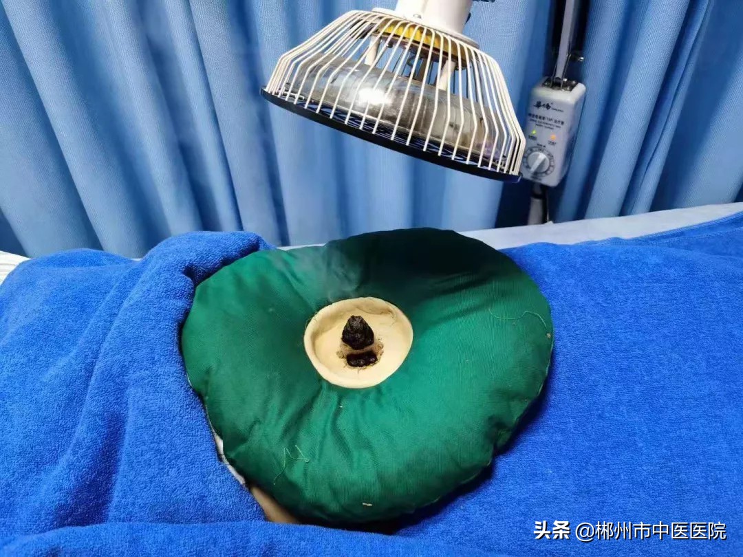 中医讲解月经不调调理方案,月经不调看中医挂什么科