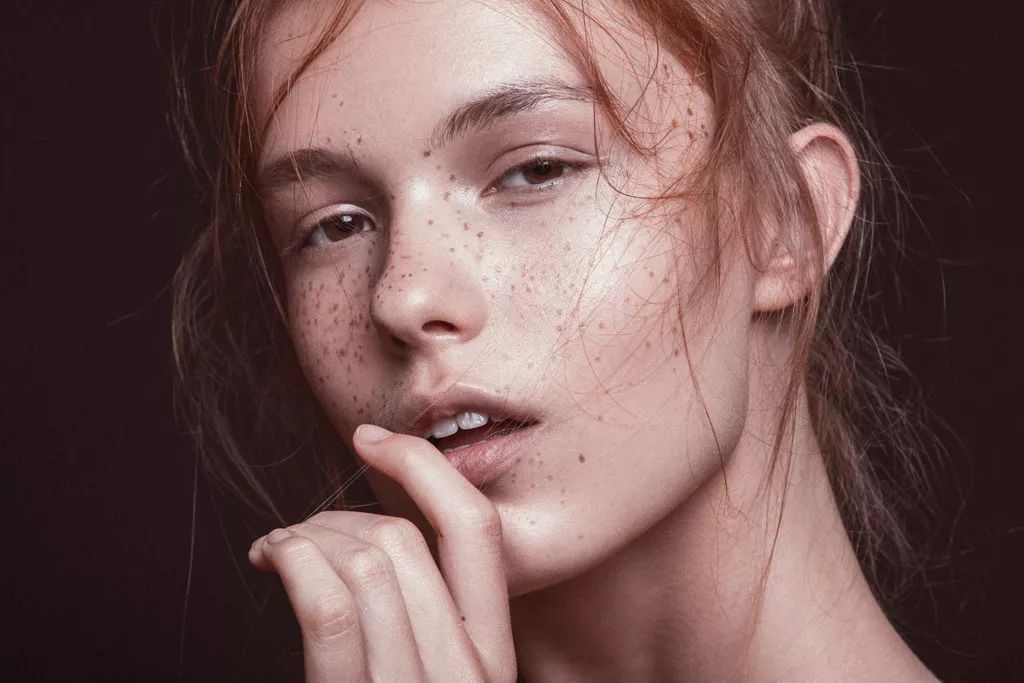 传说中效果倍儿好的超皮秒祛斑，真的这么神奇吗？