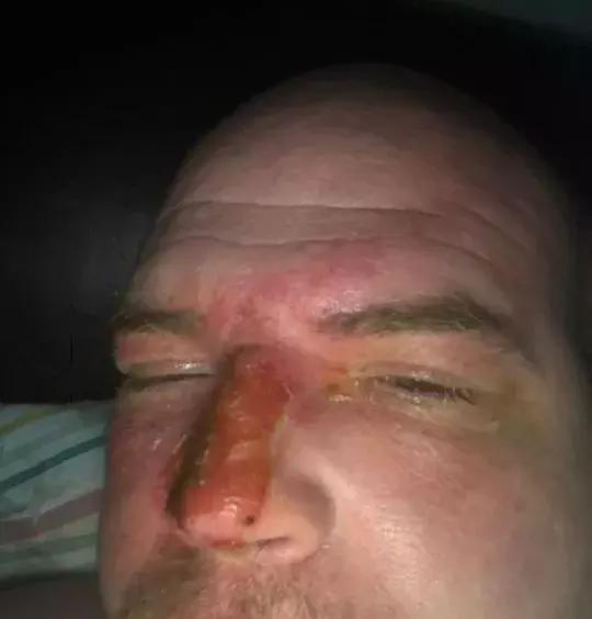 因为一时疏忽让自己悔恨终生,因为一时的疏忽造成了终身后悔