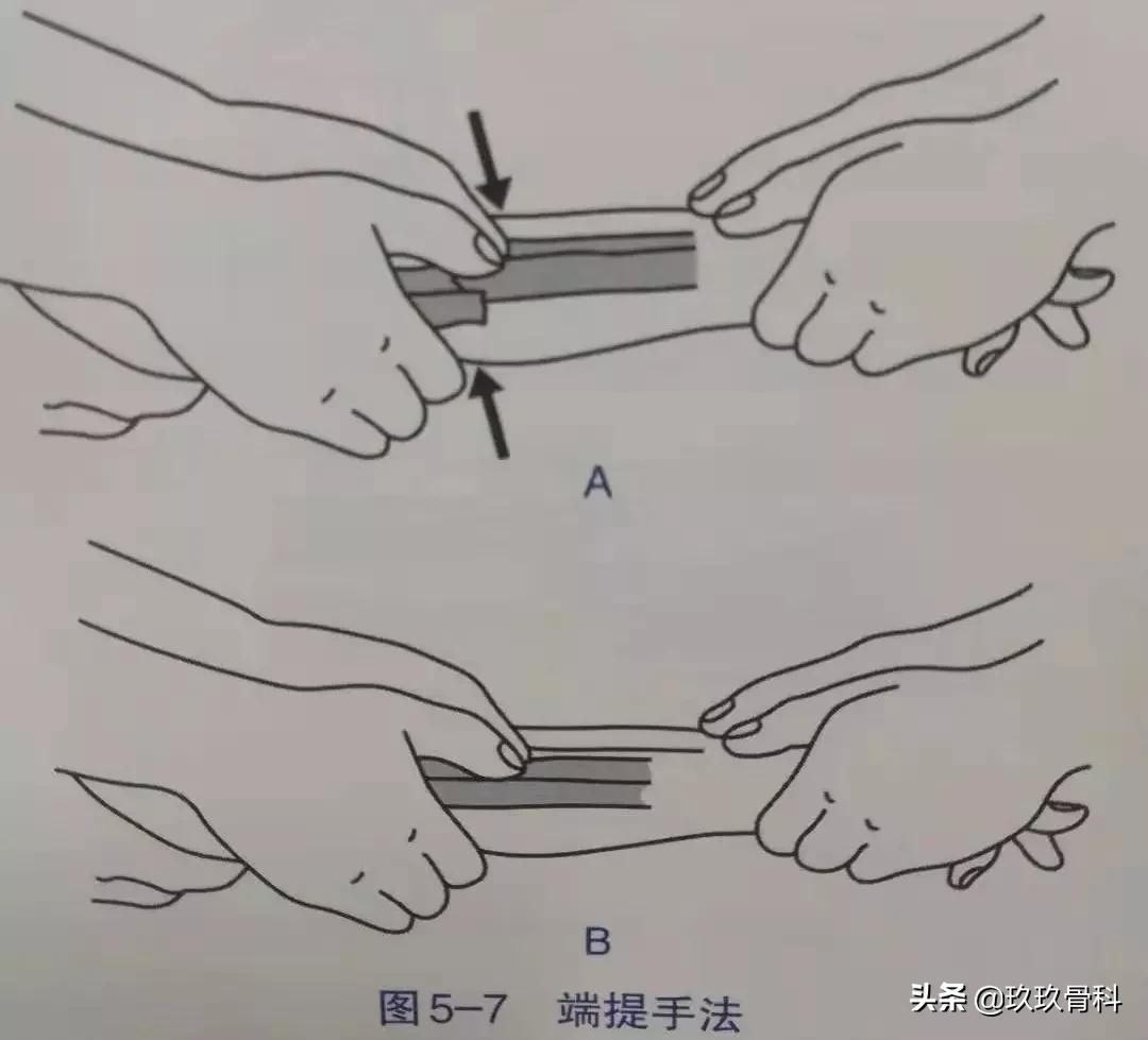 骨折手法整复术多少钱,骨折恢复手法视频教程