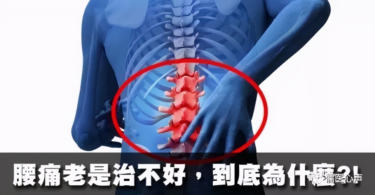 腰痛之捉妖记（十二）------腰痛？也许你得了“神经病”