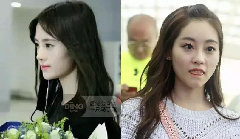 凹面型侧脸怎么改善,凹面型侧脸是怎么造成的