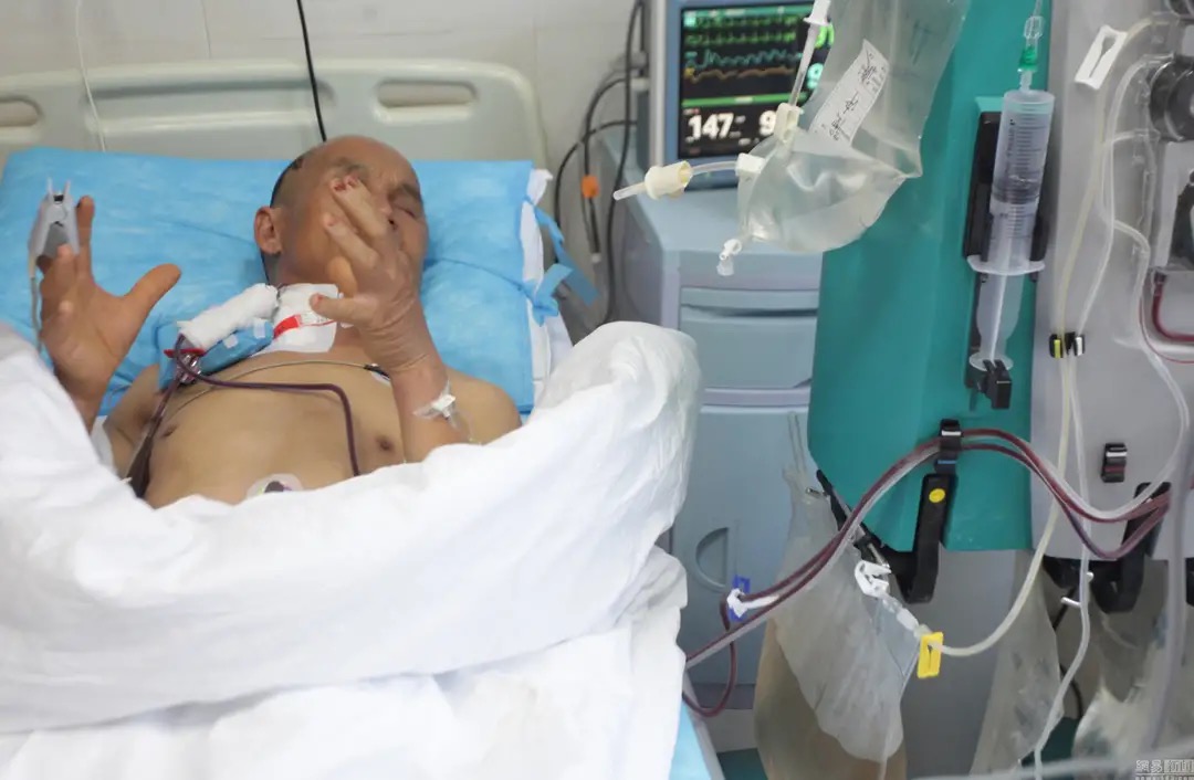 广西马蜂蜇伤事件,扫墓被马蜂蜇死