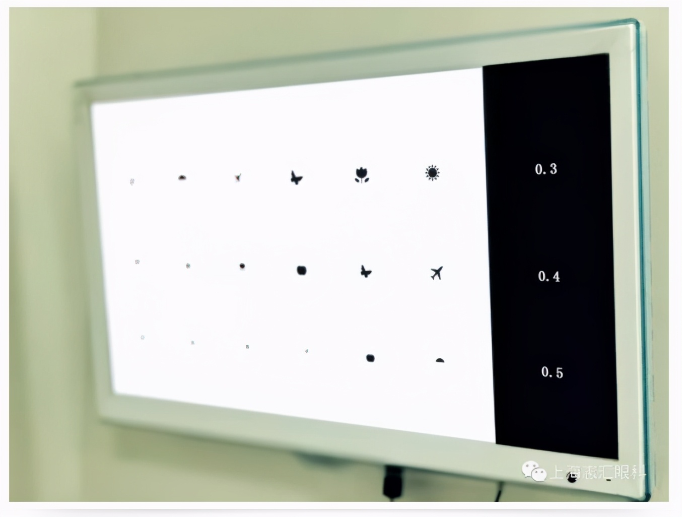 ok镜复查眼轴要停戴吗,ok镜复查需要做哪些项目