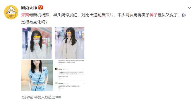 吴昕鼻子是什么样子,吴昕侧面鼻子