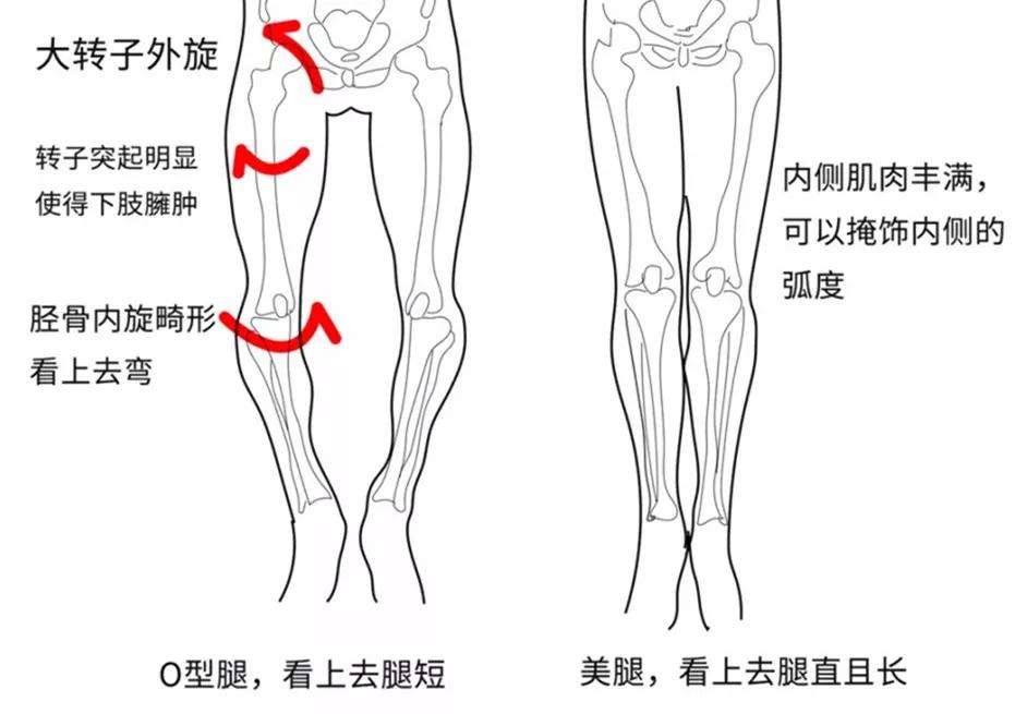练就笔直大长腿，OX腿型如何应对？！｜运动康复003课