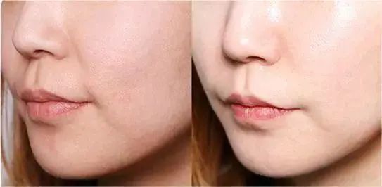 平价澳洲防晒推荐,澳洲日常防晒推荐哪款