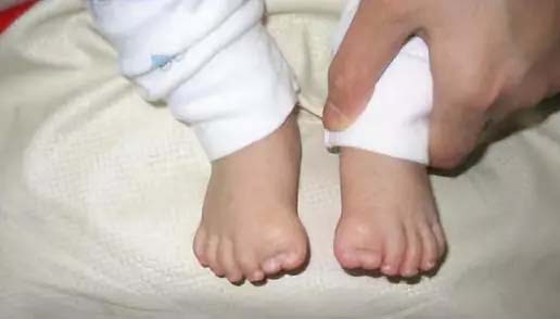 儿童骨科和成人骨科有什么区别,小儿骨科辟谣