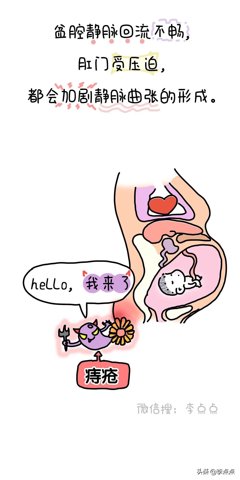 刚生完孩子痔疮严重怎么消肿止痛,生了个痔疮