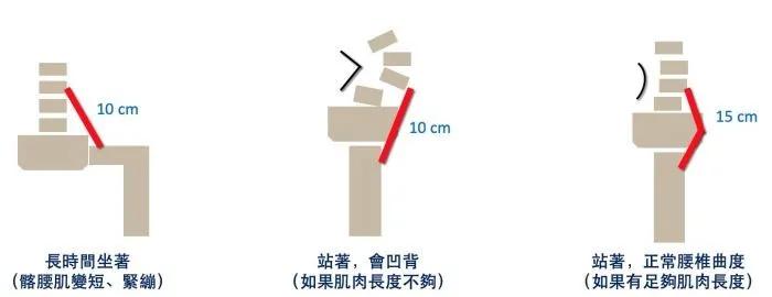 为什么肌肉总是紧绷,肌肉紧绷不舒服怎么办