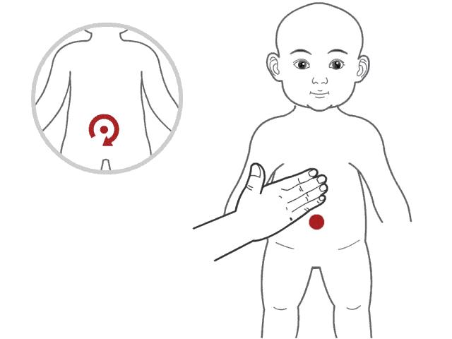 宝宝结膜炎如何推拿,小儿推拿过敏性结膜炎