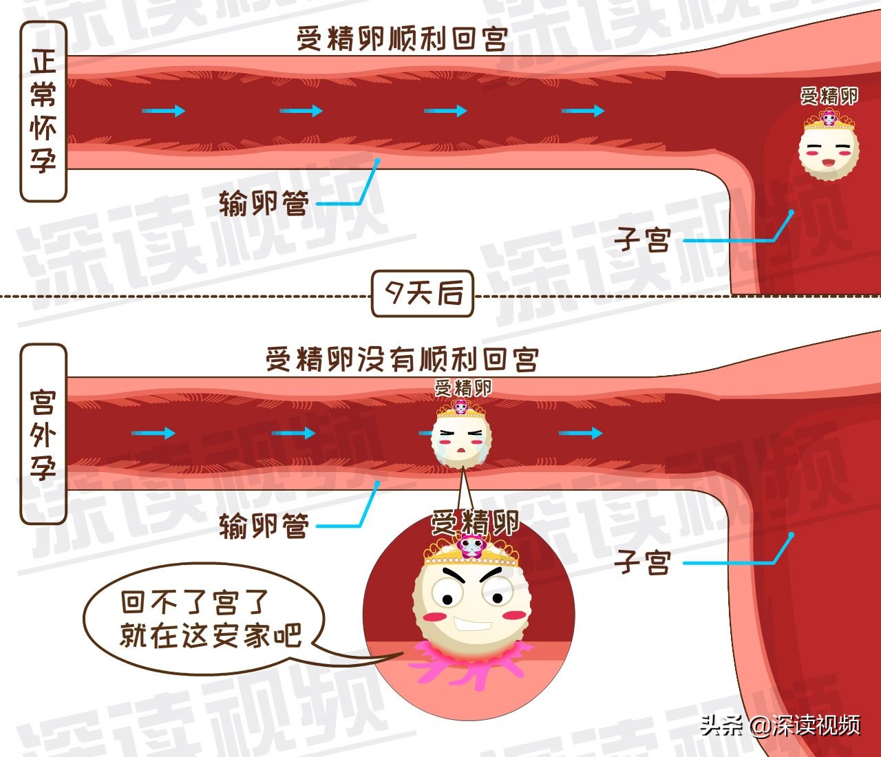 受精卵缘何子宫外安家