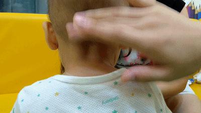 疱疹性咽峡炎高发期，家长怎么做才能防治？