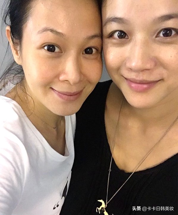 教你去除黑眼圈的七个小方法,去除黑眼圈四个最有效最快小绝招