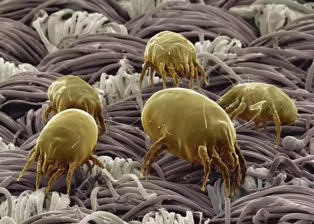 螨虫叮咬传播疾病,尘螨叮咬怎么治疗